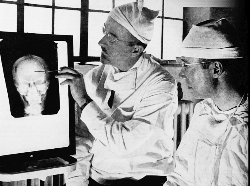 Tohtorit Freeman ja Watts tutkivat röntgenkuvaa potilaan aivoista ennen lobotomiaa.