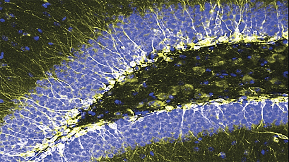 Turun biotekniikan keskuksen Cell Image Core -yksikössä otettu kuva hippokampuksesta,