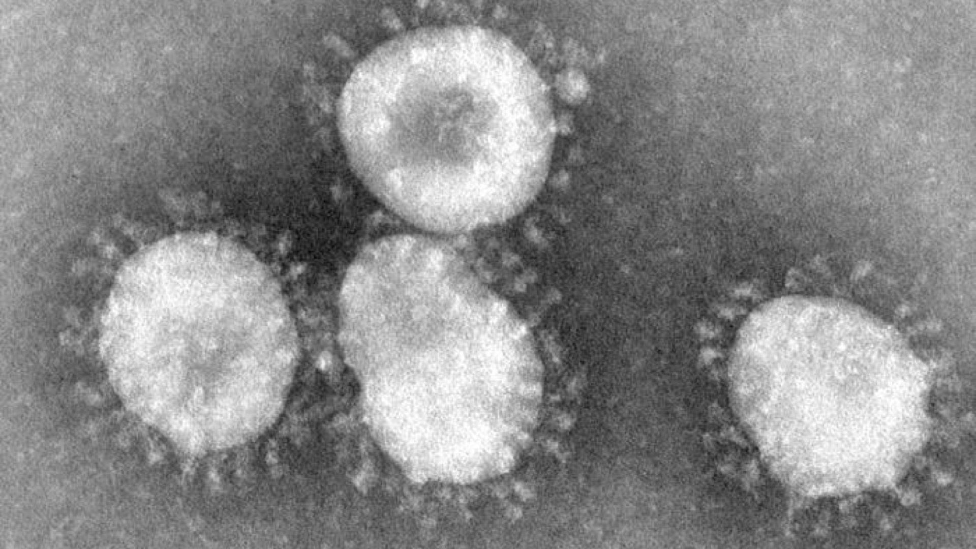 Koronavirus